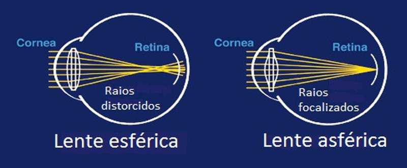 Diagrama comparando raios distorcidos em lente esférica com raios focalizados em lente asférica.