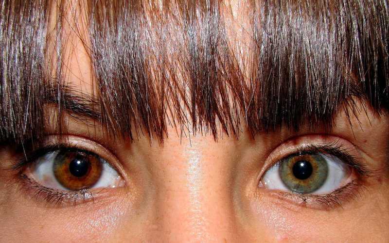 heterocromia: diferente cores entre os olhos de uma mesma pessoa